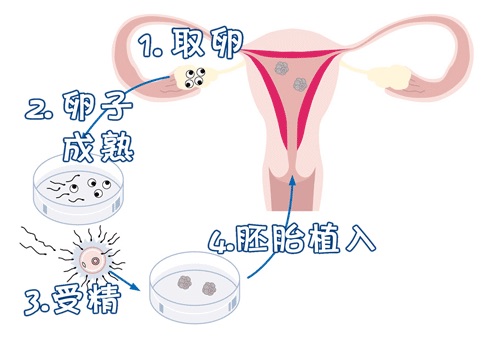 PGT胚胎实验室